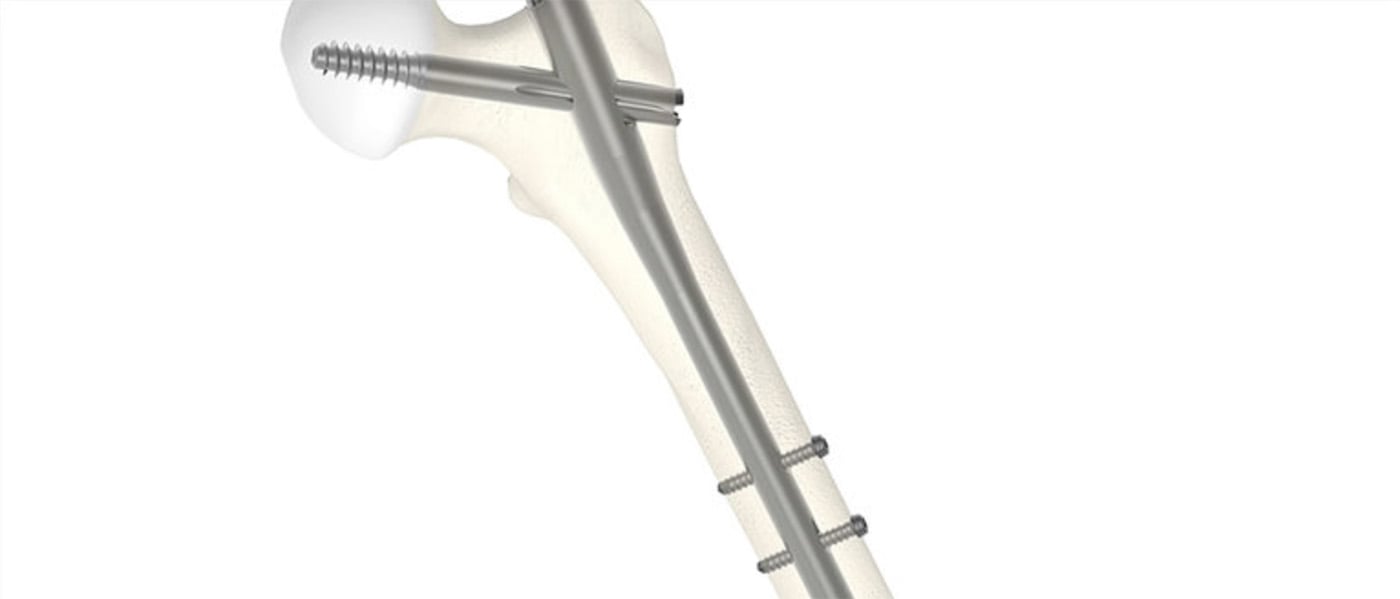 Stryker expands Gamma4 portfolio to meet the needs of surgeons and their patients